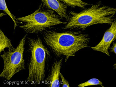 Immunocytochemistry/ Immunofluorescence - Goat Anti-Chicken IgY H&L (Alexa Fluor® 555) (AB150170)