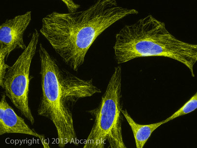 Immunocytochemistry/ Immunofluorescence - Goat Anti-Chicken IgY H&L (Alexa Fluor® 555) preadsorbed (AB150174), expandable thumbnail