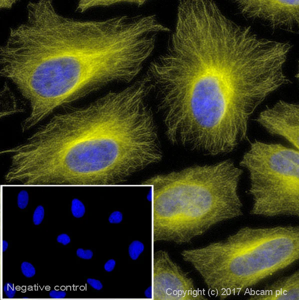 gっfy mita and Offspring Link Up for Adidas ZX 8000 Collab