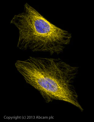 Immunocytochemistry/ Immunofluorescence - Goat Anti-Chicken IgY H&L (Alexa Fluor® 568) preadsorbed (AB175711)