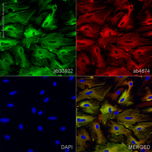 Immunocytochemistry/ Immunofluorescence - Goat Anti-Chicken IgY H&L (Alexa Fluor® 594) preadsorbed (ab150176), expandable thumbnail