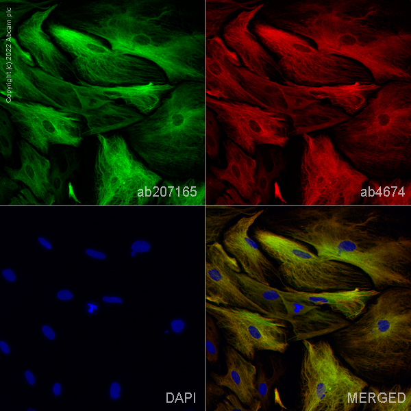 Immunocytochemistry/ Immunofluorescence - Goat Anti-Chicken IgY H&L (Alexa Fluor® 594) preadsorbed (ab150176), expandable thumbnail