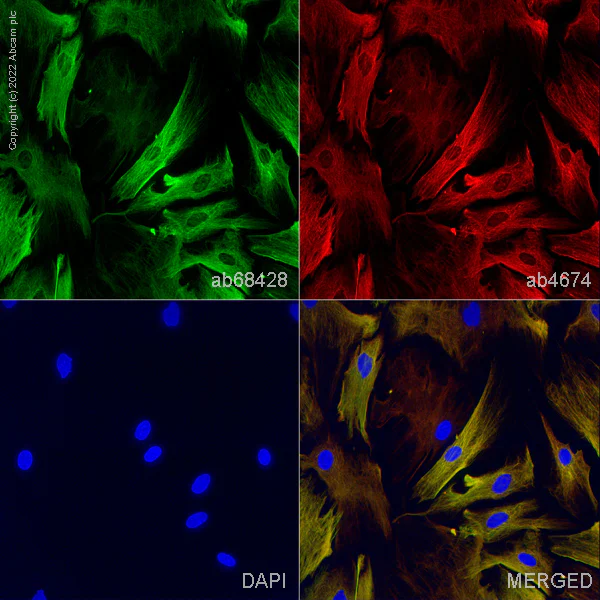Immunocytochemistry/ Immunofluorescence - Goat Anti-Chicken IgY H&L (Alexa Fluor® 594) preadsorbed (AB150176)