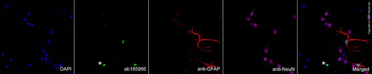 Immunocytochemistry/ Immunofluorescence - Goat Anti-Chicken IgY H&L (Alexa Fluor® 594) preadsorbed (AB150176)