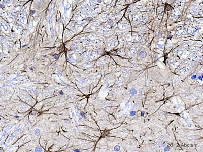 Immunohistochemistry (Formalin/PFA-fixed paraffin-embedded sections) - Goat Anti-Chicken IgY H&L (Biotin) (AB6876), expandable thumbnail