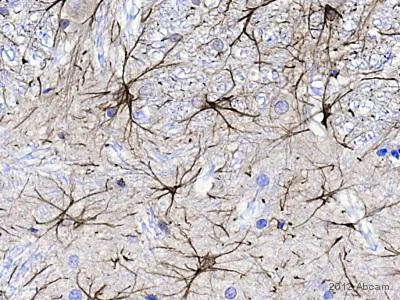 Immunohistochemistry (Formalin/PFA-fixed paraffin-embedded sections) - Goat Anti-Chicken IgY H&L (Biotin) (AB6876)