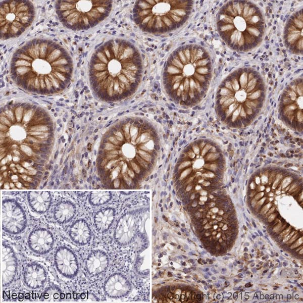 Immunohistochemistry (Formalin/PFA-fixed paraffin-embedded sections) - Goat Anti-Chicken IgY H&L (HRP) (AB205721), expandable thumbnail