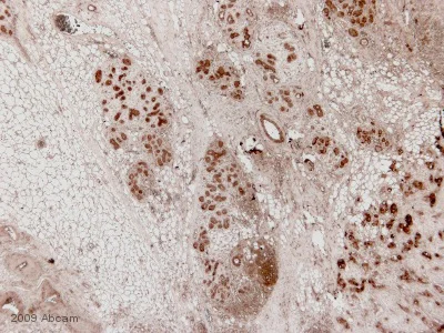 Immunohistochemistry (Formalin/PFA-fixed paraffin-embedded sections) - Goat Anti-Chicken IgY H&L (HRP) (AB6877)