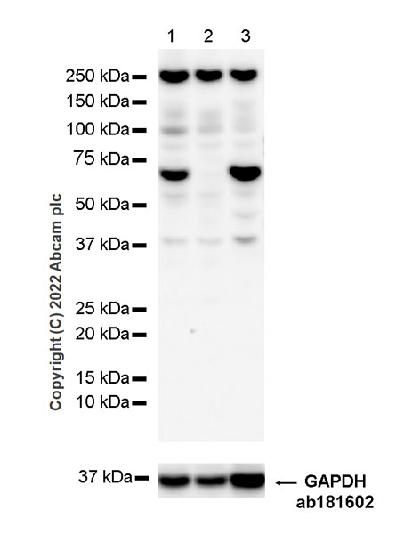 Western blot - Goat Anti-Chicken IgY H&L (HRP) (ab6877), expandable thumbnail