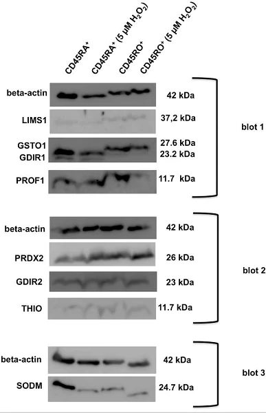 Western blot - Goat Anti-Chicken IgY H&L (HRP) (AB6877)