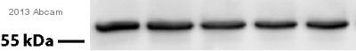 Western blot - Goat Anti-Chicken IgY H&L (HRP) (AB97135), expandable thumbnail
