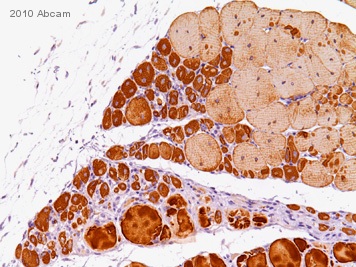 Immunohistochemistry (Formalin/PFA-fixed paraffin-embedded sections) - Goat F(ab) Anti-Mouse IgG H&L (HRP) (AB6823)