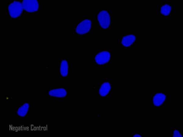 Immunocytochemistry/ Immunofluorescence - Goat Anti-Guinea pig IgG H&L (Alexa Fluor® 555) (AB150186), expandable thumbnail