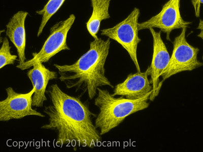 Immunocytochemistry/ Immunofluorescence - Goat Anti-Guinea pig IgG H&L (Alexa Fluor® 555) (AB150186), expandable thumbnail