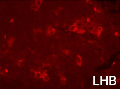 Immunohistochemistry (Formalin/PFA-fixed paraffin-embedded sections) - Goat Anti-Guinea pig IgG H&L (Texas Red ®) (AB6906), expandable thumbnail