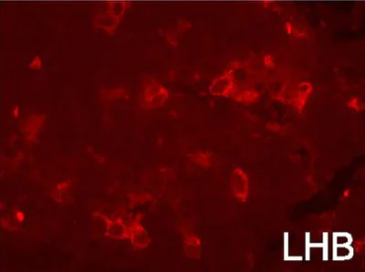 Immunohistochemistry (Formalin/PFA-fixed paraffin-embedded sections) - Goat Anti-Guinea pig IgG H&L (Texas Red ®) (AB6906)