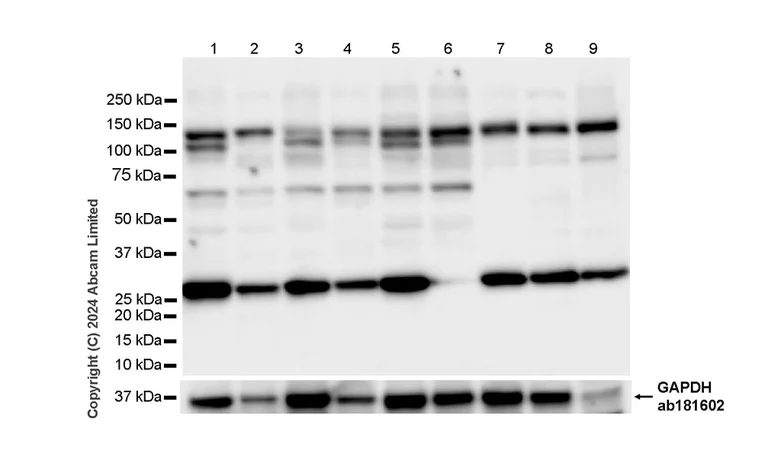 Western blot - Goat Anti-Human IgG Fc (HRP) preadsorbed (AB98624)