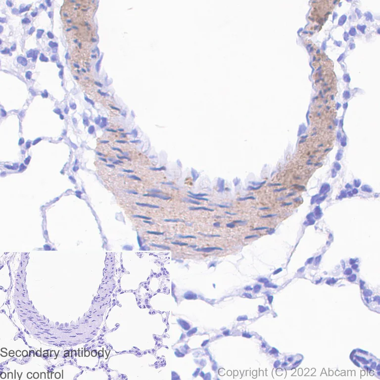 Immunohistochemistry (Formalin/PFA-fixed paraffin-embedded sections) - Goat Anti-Human IgG H&L (HRP) (AB6858)