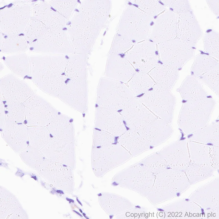 Immunohistochemistry (Formalin/PFA-fixed paraffin-embedded sections) - Goat Anti-Human IgG H&L (HRP) (AB6858)