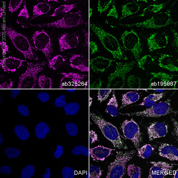 Immunocytochemistry/ Immunofluorescence - Goat Anti-Mouse IgG H&L (Alexa Fluor® 488) (AB150113)