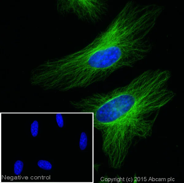 Goat anti-mouse IgG (Alexa Fluor® 488) secondary antibody Goat anti-mouse IgG (Alexa Fluor® 488) secondary antibody