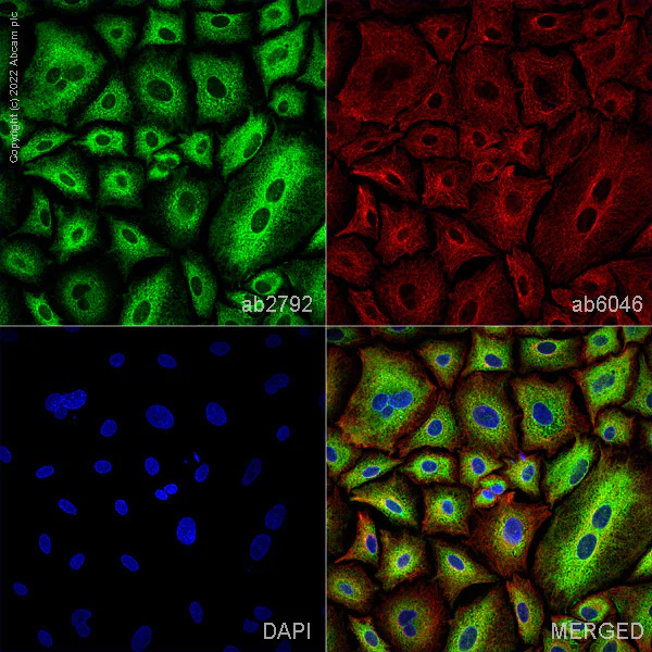Immunocytochemistry/ Immunofluorescence - Goat Anti-Mouse IgG H&L (Alexa Fluor® 488) preadsorbed (AB150117)