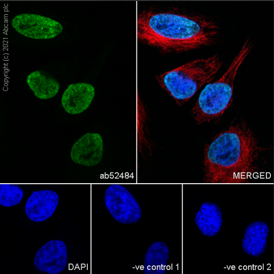 Immunocytochemistry/ Immunofluorescence - Goat Anti-Mouse IgG H&L (Alexa Fluor® 488) preadsorbed (ab150117), expandable thumbnail