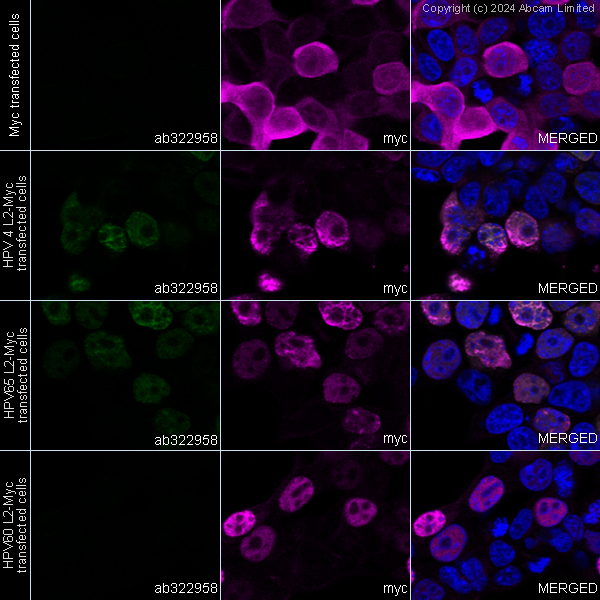 Immunocytochemistry/ Immunofluorescence - Goat Anti-Mouse IgG H&L (Alexa Fluor® 488) preadsorbed (ab150117), expandable thumbnail