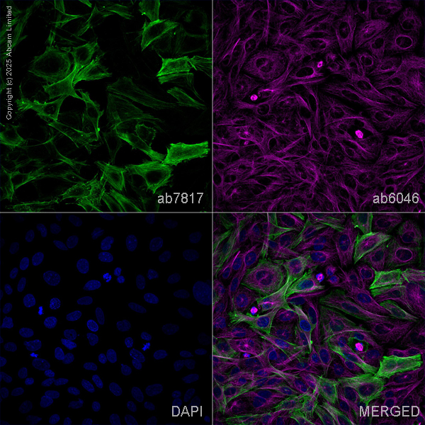 Immunocytochemistry/ Immunofluorescence - Goat Anti-Mouse IgG H&L (Alexa Fluor® 488) preadsorbed (ab150117), expandable thumbnail