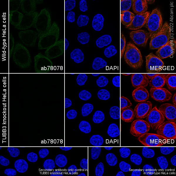 Immunocytochemistry/ Immunofluorescence - Goat Anti-Mouse IgG H&L (Alexa Fluor® 488) preadsorbed (AB150117)