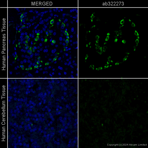 Immunohistochemistry (Formalin/PFA-fixed paraffin-embedded sections) - Goat Anti-Mouse IgG H&L (Alexa Fluor® 488) preadsorbed (ab150117), expandable thumbnail