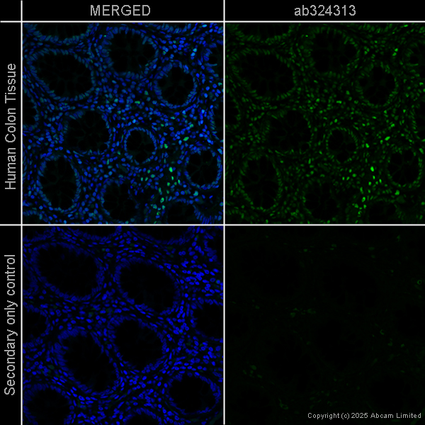 Immunohistochemistry (Formalin/PFA-fixed paraffin-embedded sections) - Goat Anti-Mouse IgG H&L (Alexa Fluor® 488) preadsorbed (ab150117), expandable thumbnail