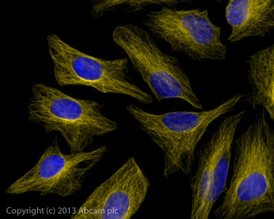 Immunocytochemistry/ Immunofluorescence - Goat Anti-Mouse IgG H&L (Alexa Fluor® 568) preadsorbed (AB175701)