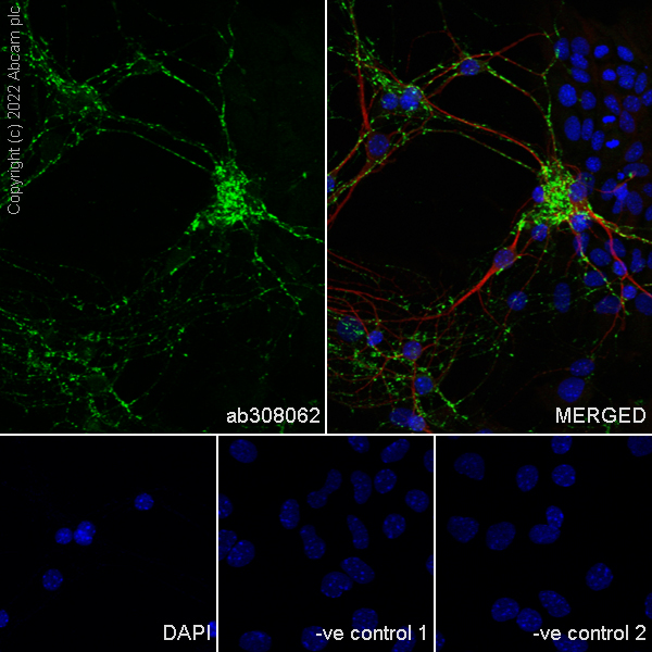 Immunocytochemistry/ Immunofluorescence - Goat Anti-Mouse IgG H&L (Alexa Fluor® 594) preadsorbed (ab150120), expandable thumbnail