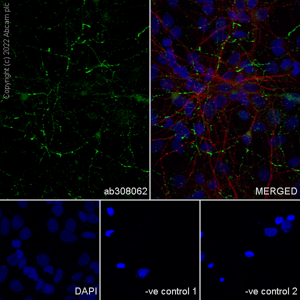 Immunocytochemistry/ Immunofluorescence - Goat Anti-Mouse IgG H&L (Alexa Fluor® 594) preadsorbed (ab150120), expandable thumbnail