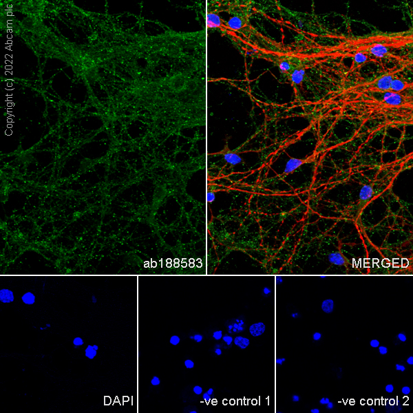 Immunocytochemistry/ Immunofluorescence - Goat Anti-Mouse IgG H&L (Alexa Fluor® 594) preadsorbed (ab150120), expandable thumbnail