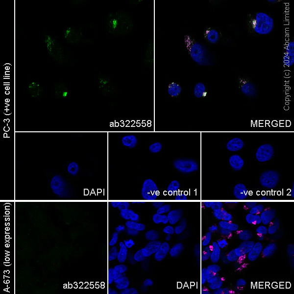 Immunocytochemistry/ Immunofluorescence - Goat Anti-Mouse IgG H&L (Alexa Fluor® 594) preadsorbed (AB150120)