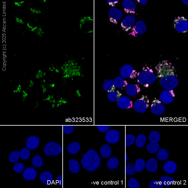 Immunocytochemistry/ Immunofluorescence - Goat Anti-Mouse IgG H&L (Alexa Fluor® 594) preadsorbed (ab150120), expandable thumbnail