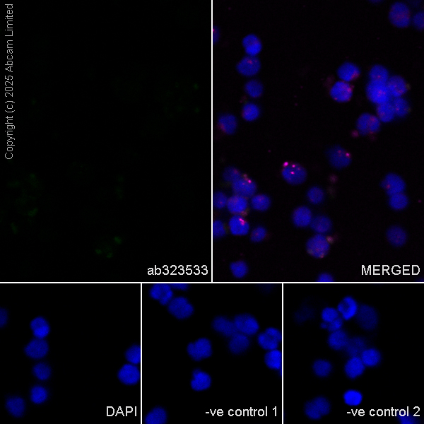 Immunocytochemistry/ Immunofluorescence - Goat Anti-Mouse IgG H&L (Alexa Fluor® 594) preadsorbed (ab150120), expandable thumbnail