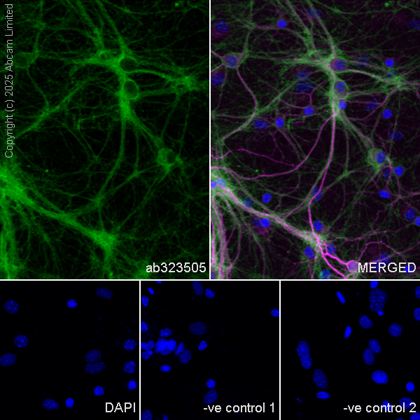 Immunocytochemistry/ Immunofluorescence - Goat Anti-Mouse IgG H&L (Alexa Fluor® 594) preadsorbed (ab150120), expandable thumbnail