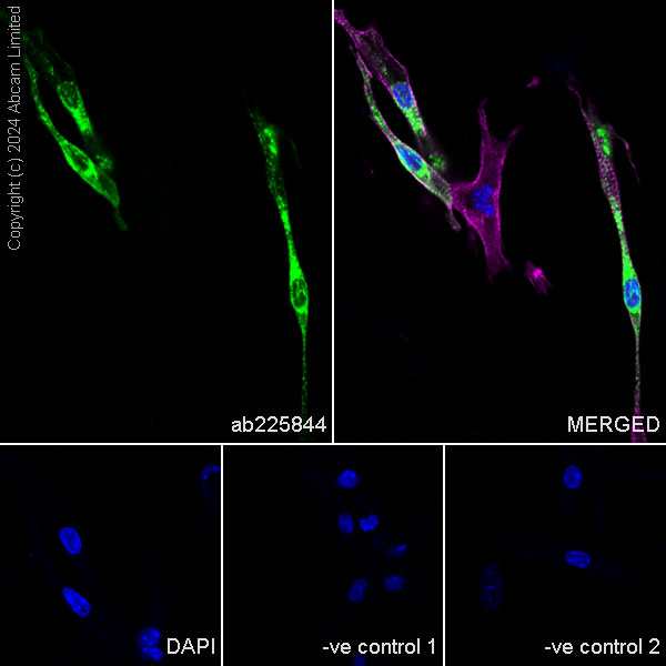 Immunocytochemistry/ Immunofluorescence - Goat Anti-Mouse IgG H&L (Alexa Fluor® 594) preadsorbed (ab150120), expandable thumbnail