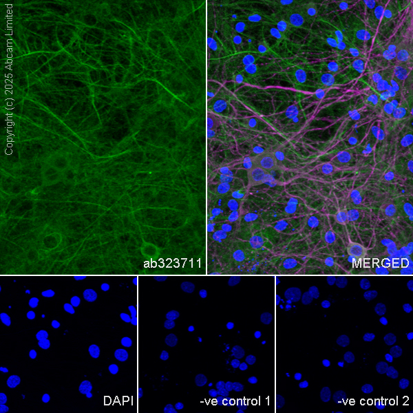 Immunocytochemistry/ Immunofluorescence - Goat Anti-Mouse IgG H&L (Alexa Fluor® 594) preadsorbed (ab150120), expandable thumbnail