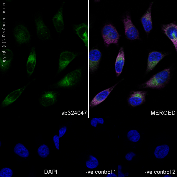 Immunocytochemistry/ Immunofluorescence - Goat Anti-Mouse IgG H&L (Alexa Fluor® 594) preadsorbed (ab150120), expandable thumbnail