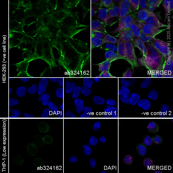 Immunocytochemistry/ Immunofluorescence - Goat Anti-Mouse IgG H&L (Alexa Fluor® 594) preadsorbed (AB150120)