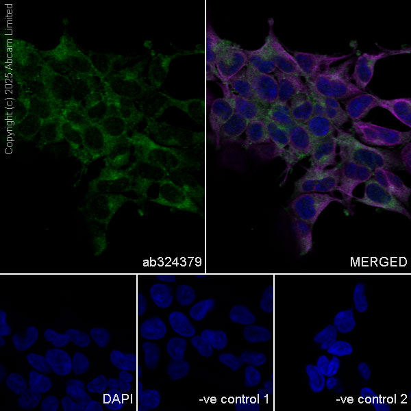 Immunocytochemistry/ Immunofluorescence - Goat Anti-Mouse IgG H&L (Alexa Fluor® 594) preadsorbed (ab150120), expandable thumbnail