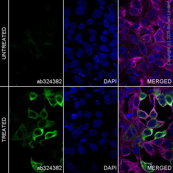 Immunocytochemistry/ Immunofluorescence - Goat Anti-Mouse IgG H&L (Alexa Fluor® 594) preadsorbed (ab150120), expandable thumbnail