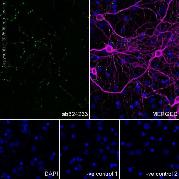 Immunocytochemistry/ Immunofluorescence - Goat Anti-Mouse IgG H&L (Alexa Fluor® 594) preadsorbed (ab150120), expandable thumbnail