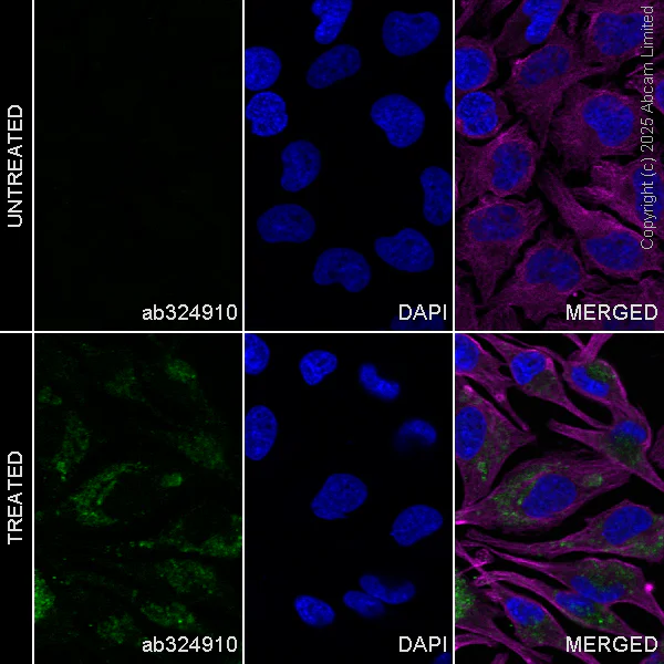 Immunocytochemistry/ Immunofluorescence - Goat Anti-Mouse IgG H&L (Alexa Fluor® 594) preadsorbed (AB150120)