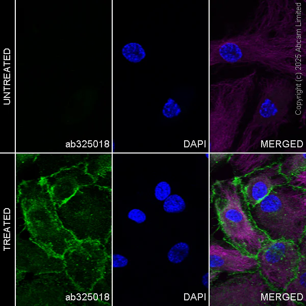 Immunocytochemistry/ Immunofluorescence - Goat Anti-Mouse IgG H&L (Alexa Fluor® 594) preadsorbed (AB150120)