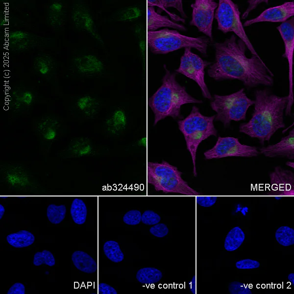 Immunocytochemistry/ Immunofluorescence - Goat Anti-Mouse IgG H&L (Alexa Fluor® 594) preadsorbed (AB150120)